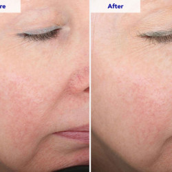 ZO SKIN HEALTH Rozatrol 50ml