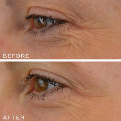Medik8 Crystal Retinal 10