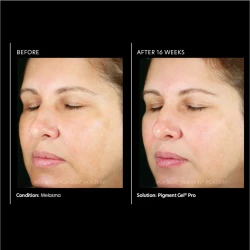PCA Skin PIGMENT GEL HQ FREE 30ML