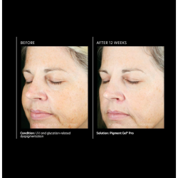 PCA Skin Pigment Gel Pro 29 ml