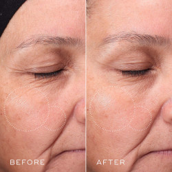 Medik8 PRESS & GLOW