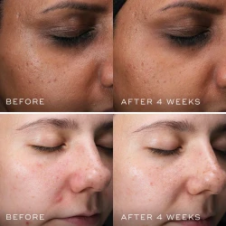 Medik8 CLARITY PEPTIDES