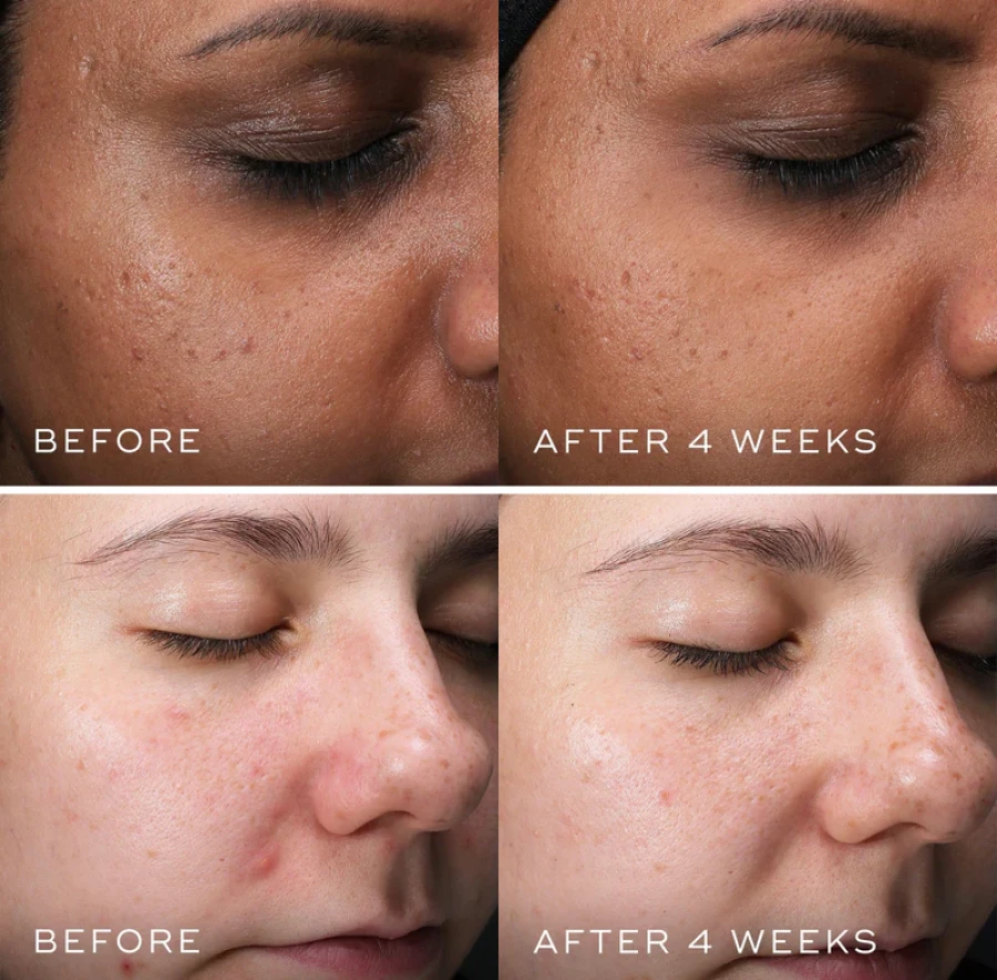 Medik8 CLARITY PEPTIDES