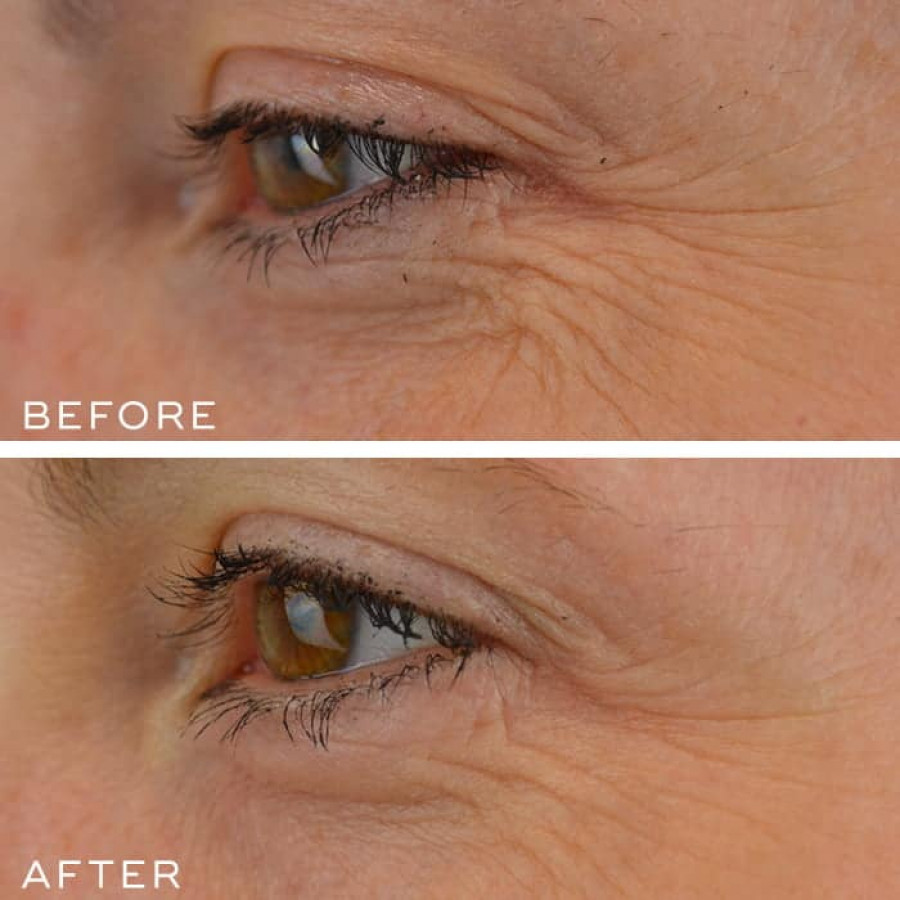 Medik8 Crystal Retinal 10