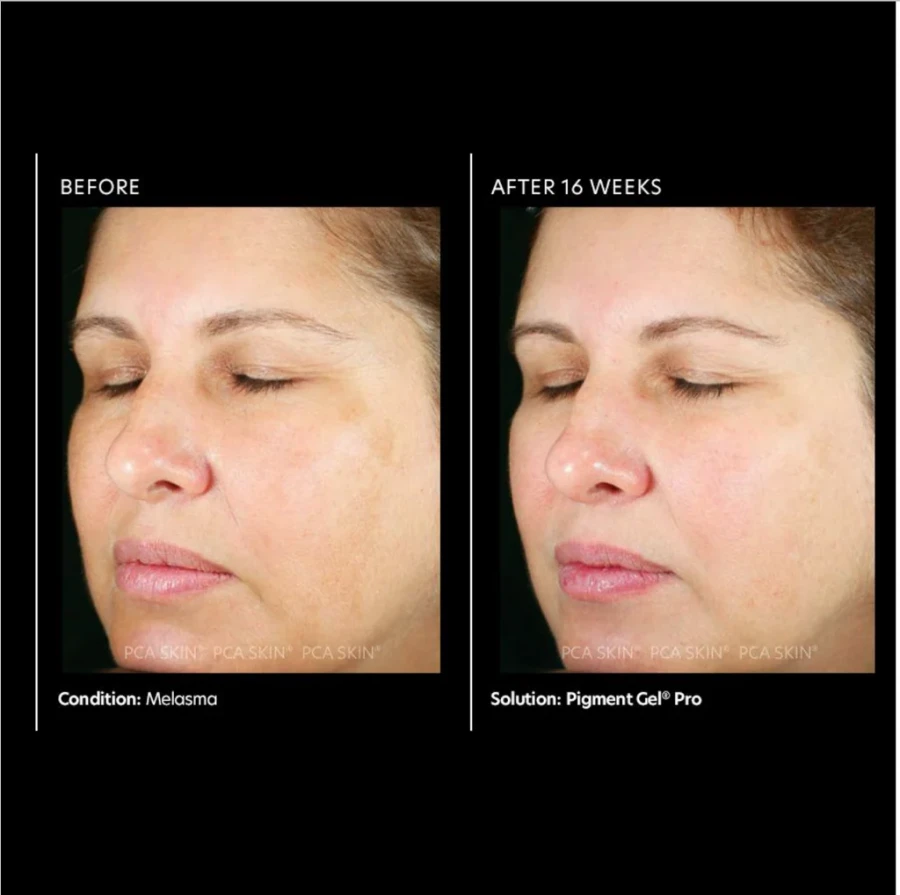 PCA Skin PIGMENT GEL HQ FREE 30ML