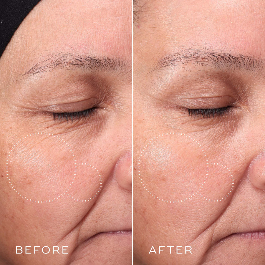 Medik8 PRESS & GLOW