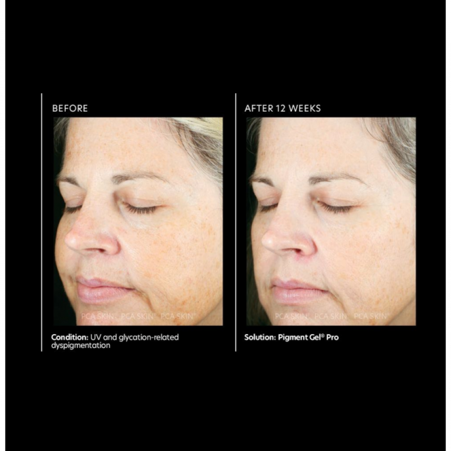 PCA Skin Pigment Gel Pro 29 ml